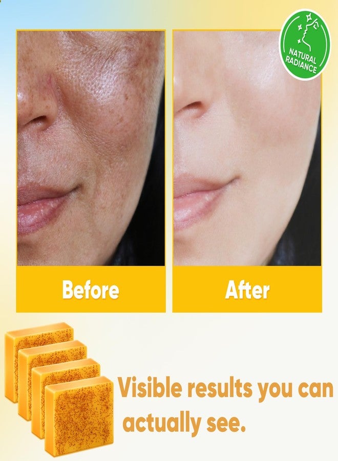 Treeroot 4 Pack Turmeric Soap, 100g Kojic Acid and Turmeric Soap Bar, Gently Clean the Face, Contains Retinol, Collagen, Vitamin C, Shea Butter, Used for Face & Body, SLS Free - Image 4